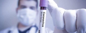 Dezvăluiri șocante! Cum pot fi manipulate rezultatele testelor Covid?