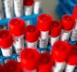 Cele mai multe localități din Prahova sunt pe 0 la Covid 19